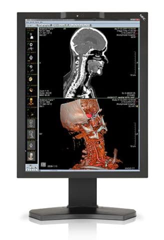 Illustration NEC Display Solutions améliore sa gamme d’écrans médicaux 