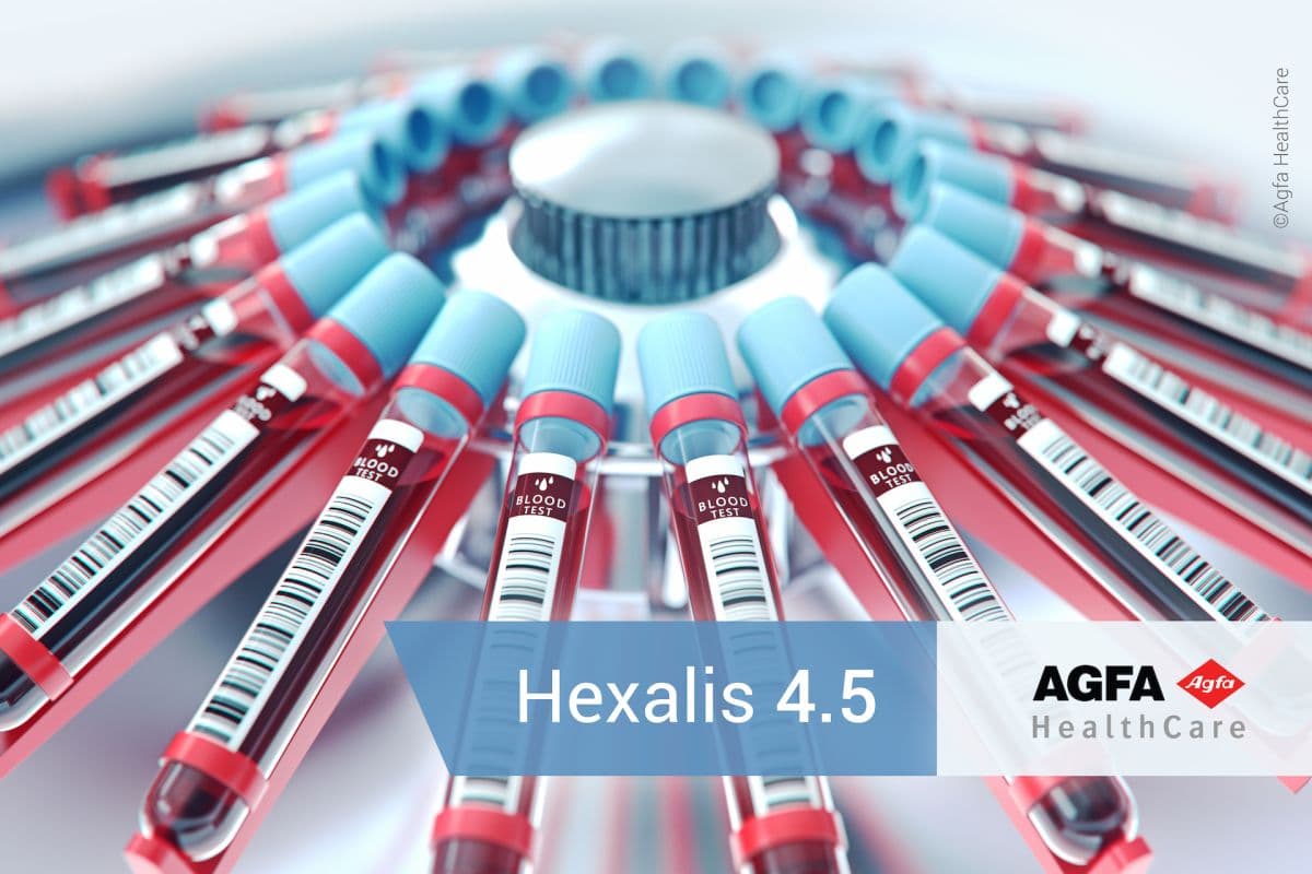 Illustration Agfa Healthcare innove en simplifiant la visualisation des résultats de biologie spécialisée grâce au module Serveur de Résultats Spécialisés (SRS)